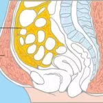 ako schudnúť z brucha